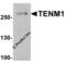 Teneurin Transmembrane Protein 1 antibody, 8149, ProSci, Western Blot image 