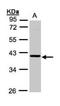 Ankyrin Repeat And SOCS Box Containing 4 antibody, NBP1-32623, Novus Biologicals, Western Blot image 