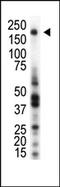 Stk antibody, AP14419PU-N, Origene, Western Blot image 