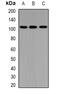Protein Tyrosine Phosphatase Non-Receptor Type 3 antibody, abx141855, Abbexa, Western Blot image 