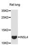 Insulin Like 4 antibody, LS-C748088, Lifespan Biosciences, Western Blot image 