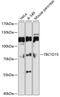 TBC1 Domain Family Member 15 antibody, 13-747, ProSci, Western Blot image 