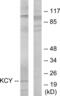 Cytidine/Uridine Monophosphate Kinase 1 antibody, abx013458, Abbexa, Western Blot image 