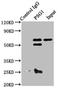 Pregnancy Specific Beta-1-Glycoprotein 1 antibody, LS-C376408, Lifespan Biosciences, Immunoprecipitation image 