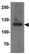 Endoplasmic Reticulum Aminopeptidase 2 antibody, GTX17208, GeneTex, Western Blot image 