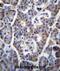Tumor Protein P53 Inducible Nuclear Protein 1 antibody, abx026490, Abbexa, Immunohistochemistry frozen image 