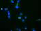 Trafficking Protein Particle Complex 4 antibody, MA5-26173, Invitrogen Antibodies, Immunocytochemistry image 