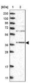 Serine/Threonine Kinase Receptor Associated Protein antibody, NBP1-82796, Novus Biologicals, Western Blot image 