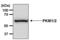 Pyruvate Kinase M1/2 antibody, MA5-14815, Invitrogen Antibodies, Western Blot image 