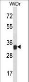 Galectin 9 antibody, LS-C165752, Lifespan Biosciences, Western Blot image 