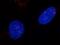 RAD51 Recombinase antibody, GTX00719, GeneTex, Immunocytochemistry image 