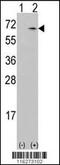 Calcium/calmodulin-dependent protein kinase kinase 1 antibody, 63-190, ProSci, Western Blot image 