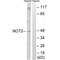 CCR4-NOT Transcription Complex Subunit 2 antibody, A06400, Boster Biological Technology, Western Blot image 