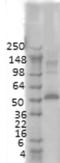 Calcium/Calmodulin Dependent Protein Kinase II Alpha antibody, GTX41976, GeneTex, Western Blot image 