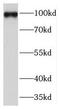 Tuftelin Interacting Protein 11 antibody, FNab08632, FineTest, Western Blot image 