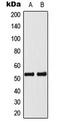 p53 antibody, LS-C354240, Lifespan Biosciences, Western Blot image 