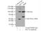 Mucin 16, Cell Surface Associated antibody, 20077-1-AP, Proteintech Group, Immunoprecipitation image 