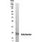 Hepatitis C Virus NS4 Antigen antibody, MA1-91550, Invitrogen Antibodies, Western Blot image 