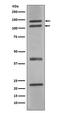 Nitric Oxide Synthase 1 antibody, M01070, Boster Biological Technology, Western Blot image 