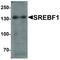 Sterol Regulatory Element Binding Transcription Factor 1 antibody, LS-C336176, Lifespan Biosciences, Western Blot image 