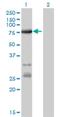 Acyl-CoA Synthetase Long Chain Family Member 5 antibody, H00051703-M01, Novus Biologicals, Western Blot image 