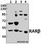 Retinoic Acid Receptor Beta antibody, A01912, Boster Biological Technology, Western Blot image 