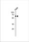 Nuclear Receptor Subfamily 1 Group D Member 2 antibody, TA324572, Origene, Western Blot image 