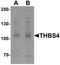 Thrombospondin 4 antibody, GTX31481, GeneTex, Western Blot image 