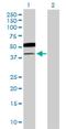 UDP-GlcNAc:BetaGal Beta-1,3-N-Acetylglucosaminyltransferase 5 antibody, H00084002-B01P, Novus Biologicals, Western Blot image 