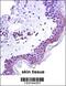 Signal Transducer And Activator Of Transcription 2 antibody, 57-243, ProSci, Immunohistochemistry paraffin image 