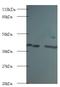 Rho GDP Dissociation Inhibitor Alpha antibody, MBS715035, MyBioSource, Western Blot image 