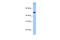 Coiled-Coil Domain Containing 50 antibody, 30-864, ProSci, Western Blot image 