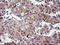 ChaC Glutathione Specific Gamma-Glutamylcyclotransferase 1 antibody, M09017, Boster Biological Technology, Immunohistochemistry paraffin image 