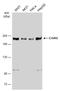 Cyclin Dependent Kinase 12 antibody, GTX130809, GeneTex, Western Blot image 