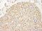 DNA Topoisomerase II Beta antibody, NB100-40842, Novus Biologicals, Immunohistochemistry paraffin image 