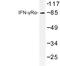 Interferon Gamma Receptor 1 antibody, LS-C176534, Lifespan Biosciences, Western Blot image 