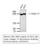 Collagen Type III Alpha 1 Chain antibody, STJ97025, St John