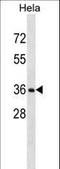 Ring Finger Protein 34 antibody, LS-C162659, Lifespan Biosciences, Western Blot image 