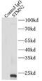 Stathmin 2 antibody, FNab08340, FineTest, Immunoprecipitation image 