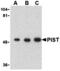 Golgi Associated PDZ And Coiled-Coil Motif Containing antibody, MBS151055, MyBioSource, Western Blot image 
