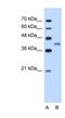 Bradykinin Receptor B2 antibody, NBP1-59044, Novus Biologicals, Western Blot image 