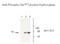 Tryptophan Hydroxylase 2 antibody, GTX31131, GeneTex, Western Blot image 