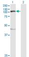 Myosin Light Chain Kinase antibody, H00004638-M01, Novus Biologicals, Western Blot image 