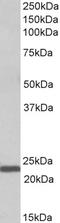 Interleukin 15 antibody, LS-C186526, Lifespan Biosciences, Western Blot image 