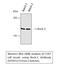 Rho Associated Coiled-Coil Containing Protein Kinase 1 antibody, A00722-3, Boster Biological Technology, Western Blot image 