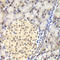 Pro-Apoptotic WT1 Regulator antibody, LS-C332345, Lifespan Biosciences, Immunohistochemistry frozen image 