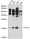 TATA-Box Binding Protein Associated Factor 12 antibody, 19-652, ProSci, Western Blot image 