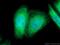 Transmembrane Protein 173 antibody, 19851-1-AP, Proteintech Group, Immunofluorescence image 