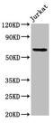 SLAIN Motif Family Member 1 antibody, CSB-PA850864LA01HU, Cusabio, Western Blot image 