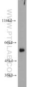 Spermatogenesis Associated 6 antibody, 11849-1-AP, Proteintech Group, Western Blot image 